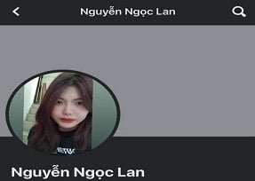 Nguyen Ngoc lan anh ตกใจร้อน